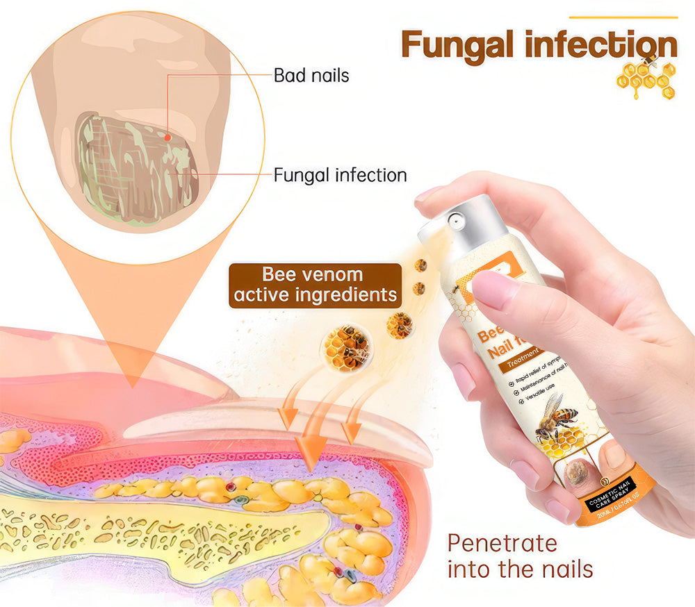 💥 2025 Limited 70% OFF ️⏳  Kolirin Bee Venom Nail Fungus Spray 💥 Fix All Nail Problems within 2 Weeks