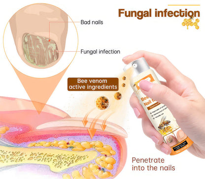 💥 2025 Limited 70% OFF ️⏳  Kolirin Bee Venom Nail Fungus Spray 💥 Fix All Nail Problems within 2 Weeks