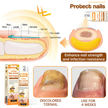 💥 2025 Limited 70% OFF ️⏳  Kolirin Bee Venom Nail Fungus Spray 💥 Fix All Nail Problems within 2 Weeks