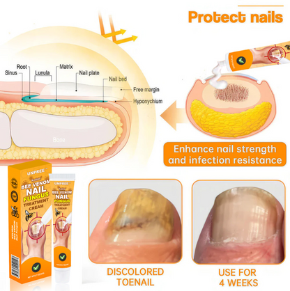 💥2025 Limited 70% OFF⏳ Kolirin Bee Venom Nail Fungus Treatment Cream