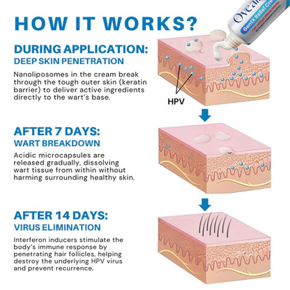 HPV Genital Warts Relief Cream