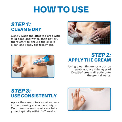 HPV Genital Warts Relief Cream