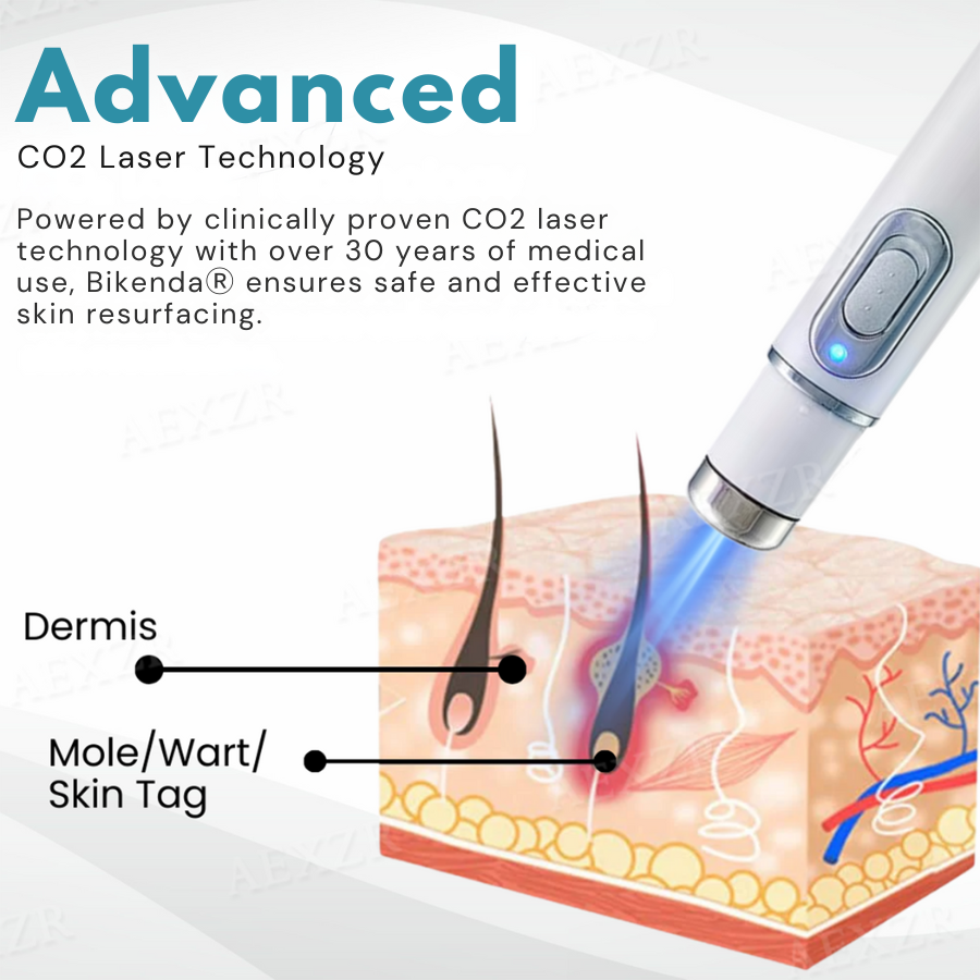 Non-Invasive Mole and Wart Removal Laser Pen PRO