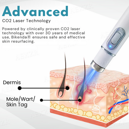 Non-Invasive Mole and Wart Removal Laser Pen PRO