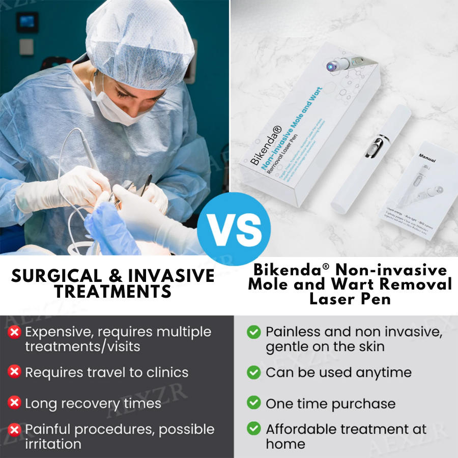 Non-Invasive Mole and Wart Removal Laser Pen PRO