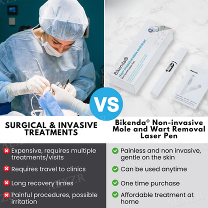 Non-Invasive Mole and Wart Removal Laser Pen PRO