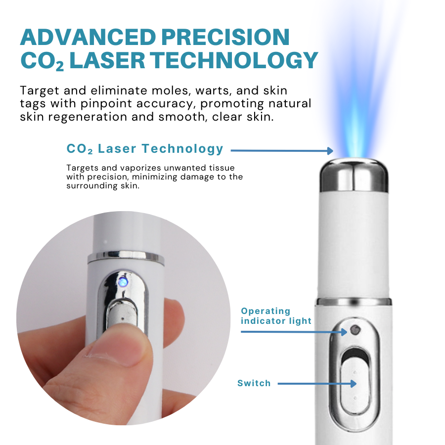 Non-Invasive Mole and Wart Removal Laser Pen PRO