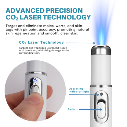 Non-Invasive Mole and Wart Removal Laser Pen PRO