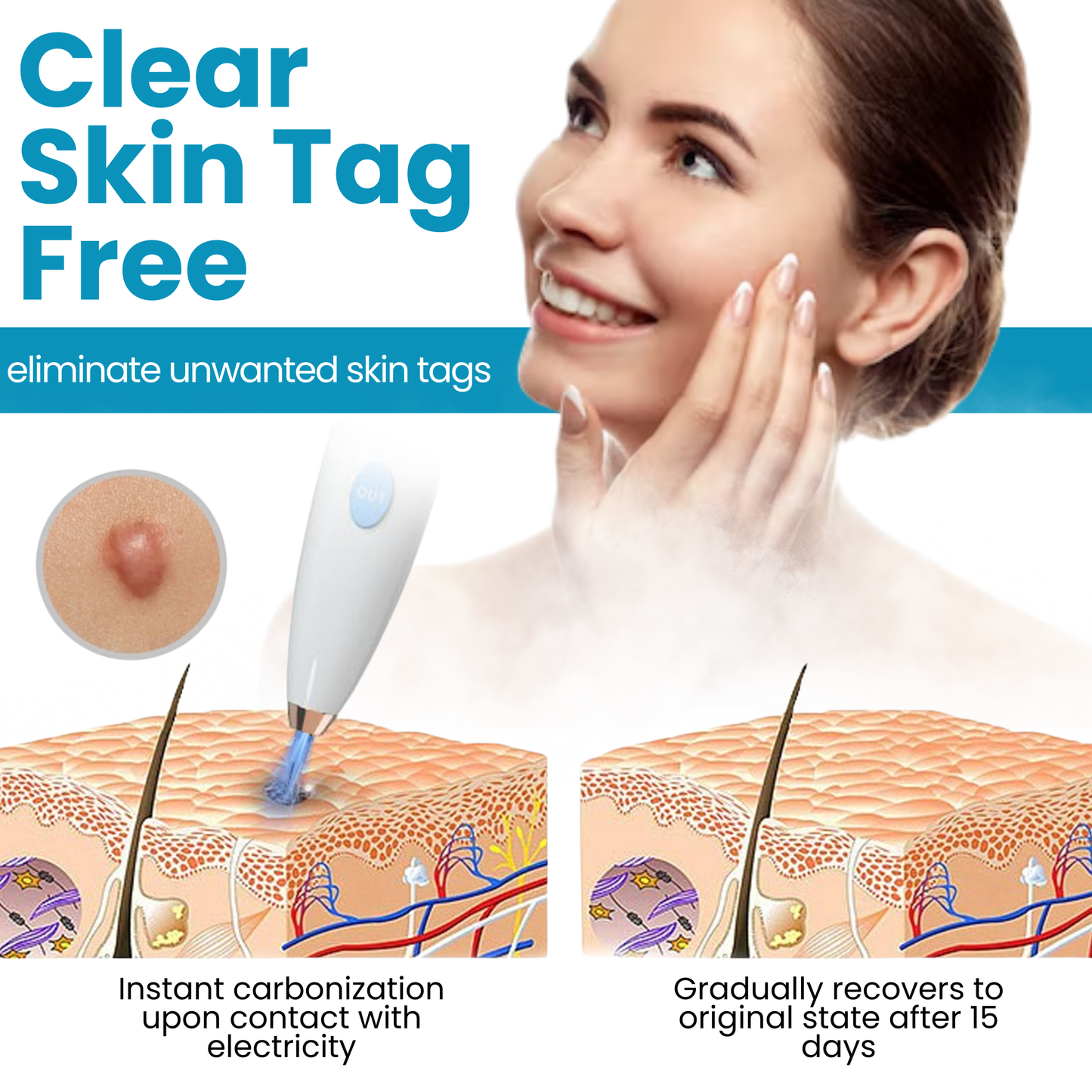 Home Use CO2 Laser Shot Erase Pro