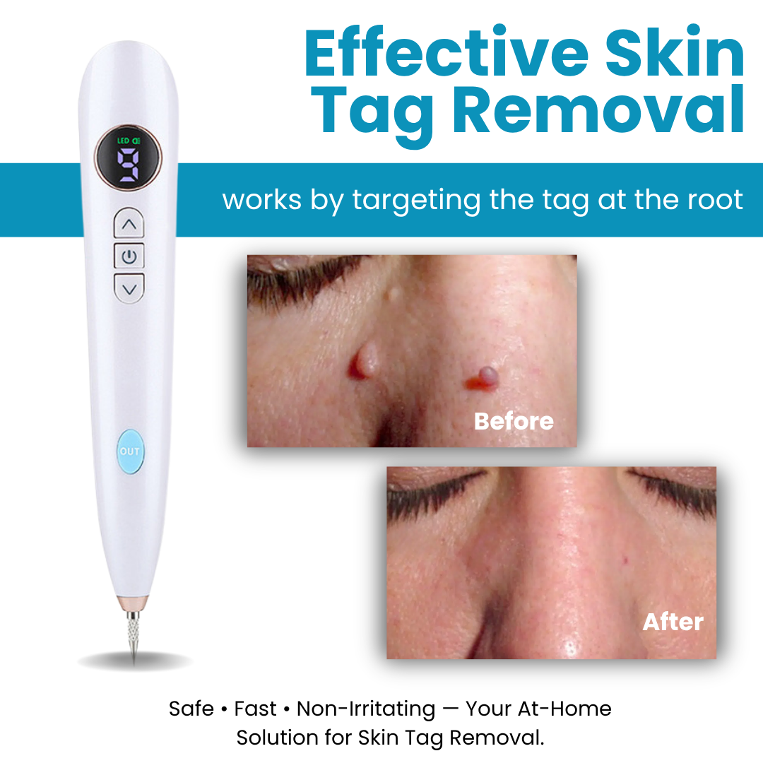 Home Use CO2 Laser Shot Erase Pro