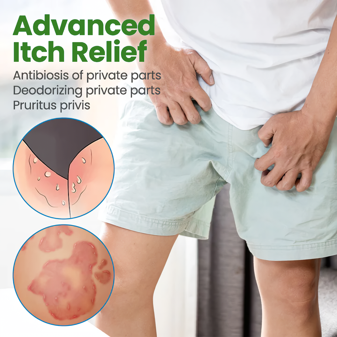 HPVCLEAR® HPV Genital Warts Relief Cream