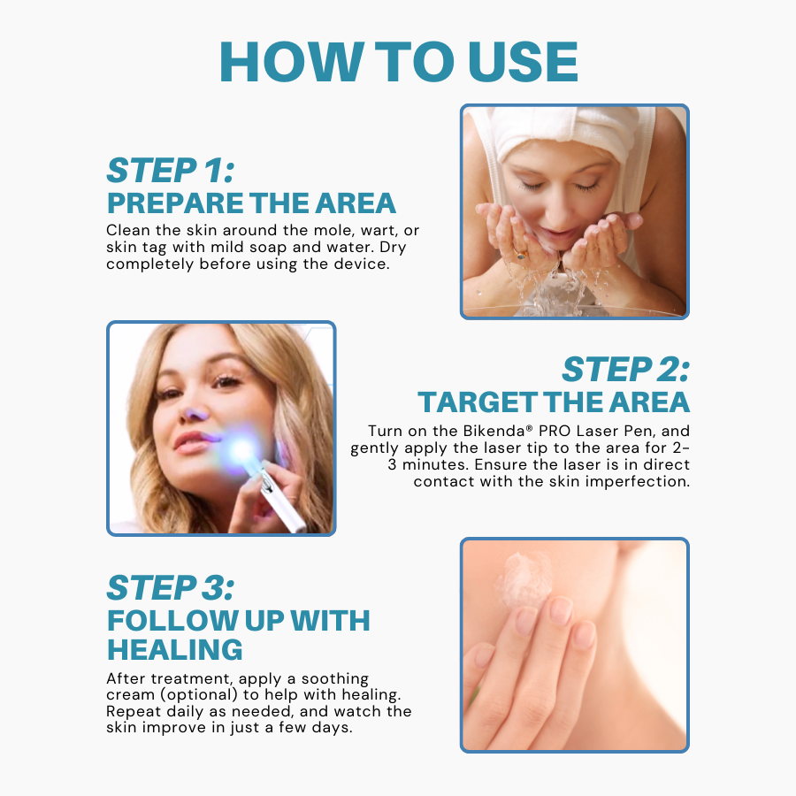 Non-Invasive Mole and Wart Removal Laser Pen PRO