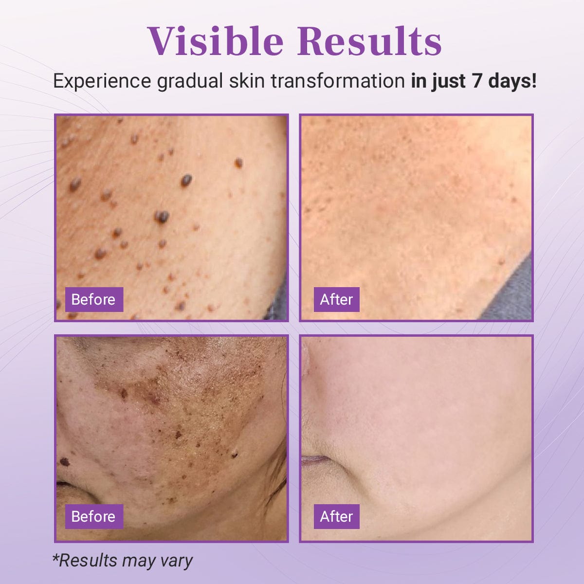 DermaClear Mole and Dark Spot Removal Bio-Gel